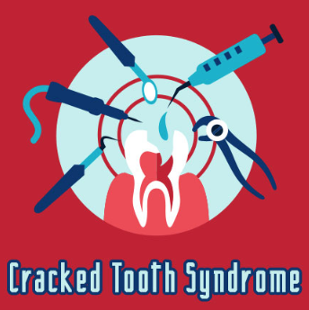 Crack Down on Cracked Tooth Syndrome