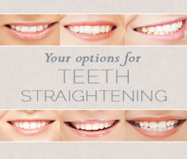 Your Options for Teeth Straightening